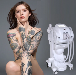 Laser Tattoo Removal 4